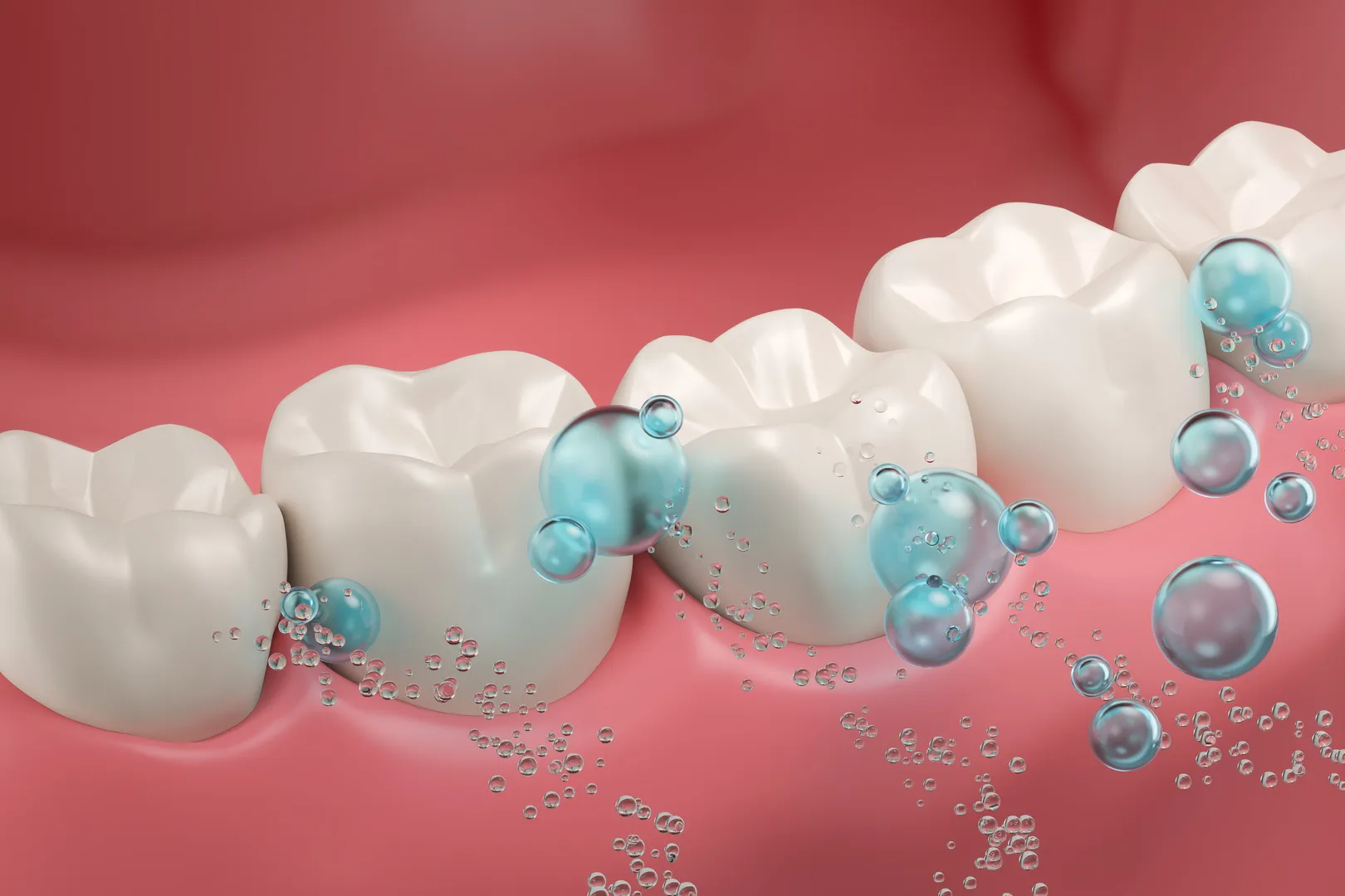 Fluoride Treatment