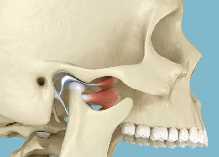 Temporomandibular Joint Disorder Treatment